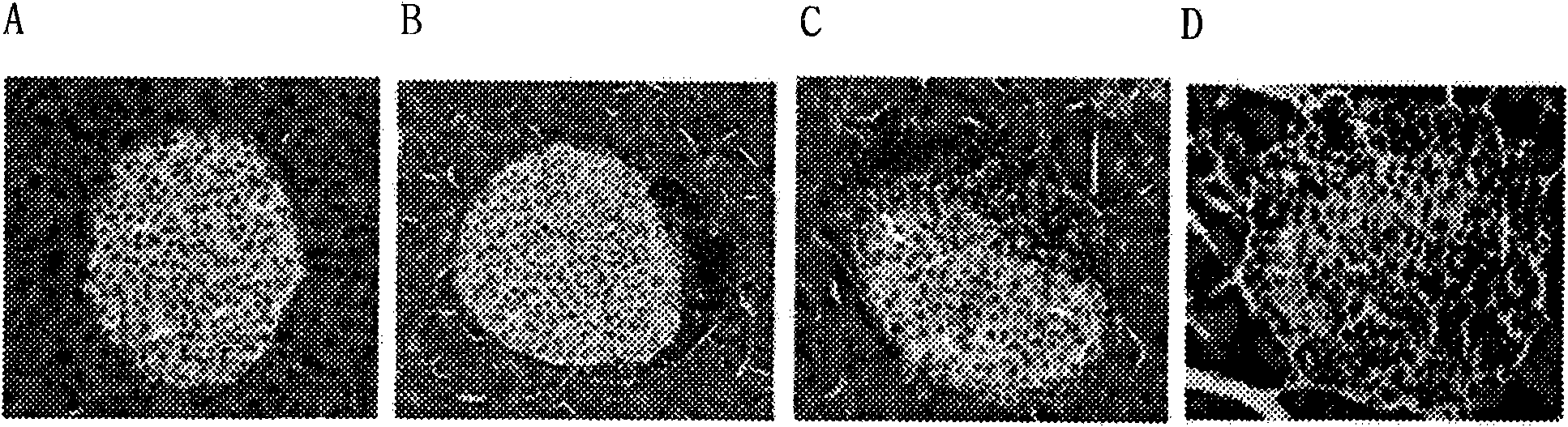 Composition comprising an extract of herbal combination thereof for preventing and treating diabetes mellitus