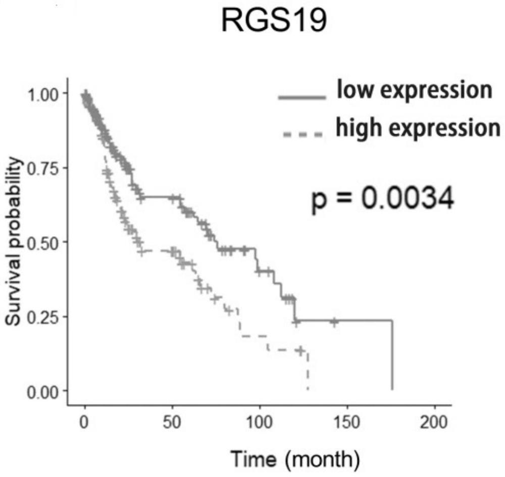 Application of RGS19 in construction of lung squamous cell carcinoma prognosis prediction model as diagnostic marker