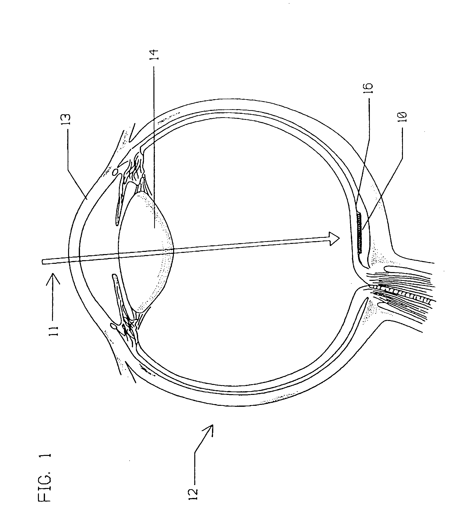 Multi-phasic microphotodetector retinal implant with variable voltage and current capability and apparatus for insertion