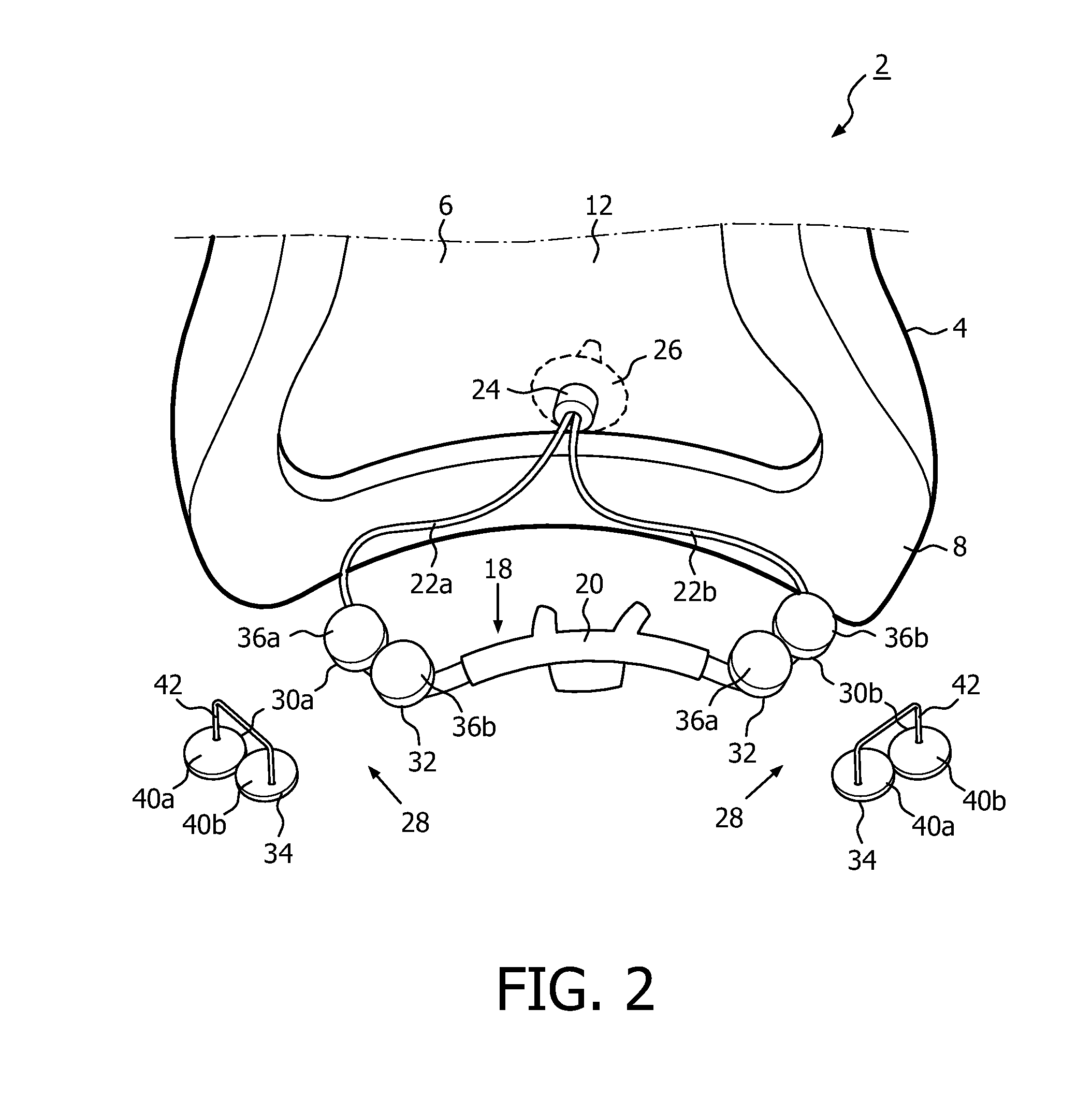 Patient interface device including a mechanism for manipulating the position of an internal component thereof