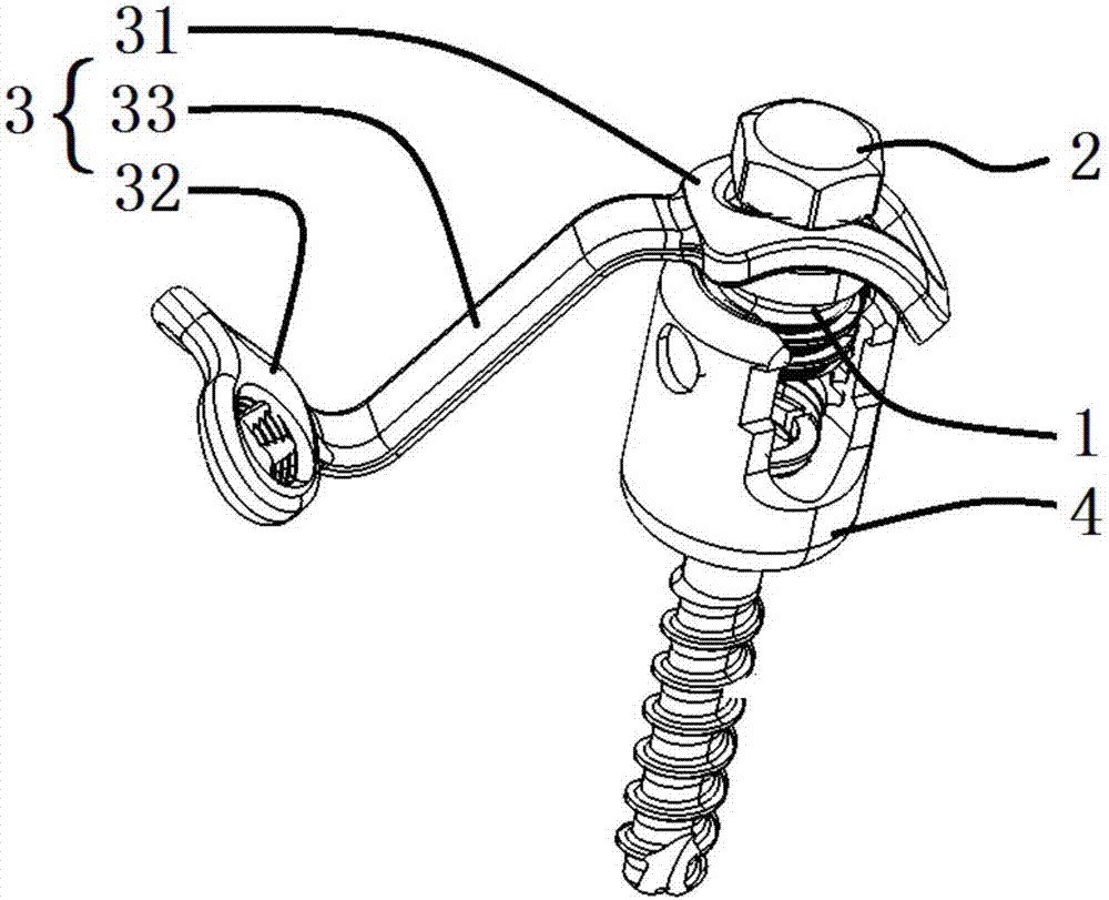 Vertebral plate reinforcing device