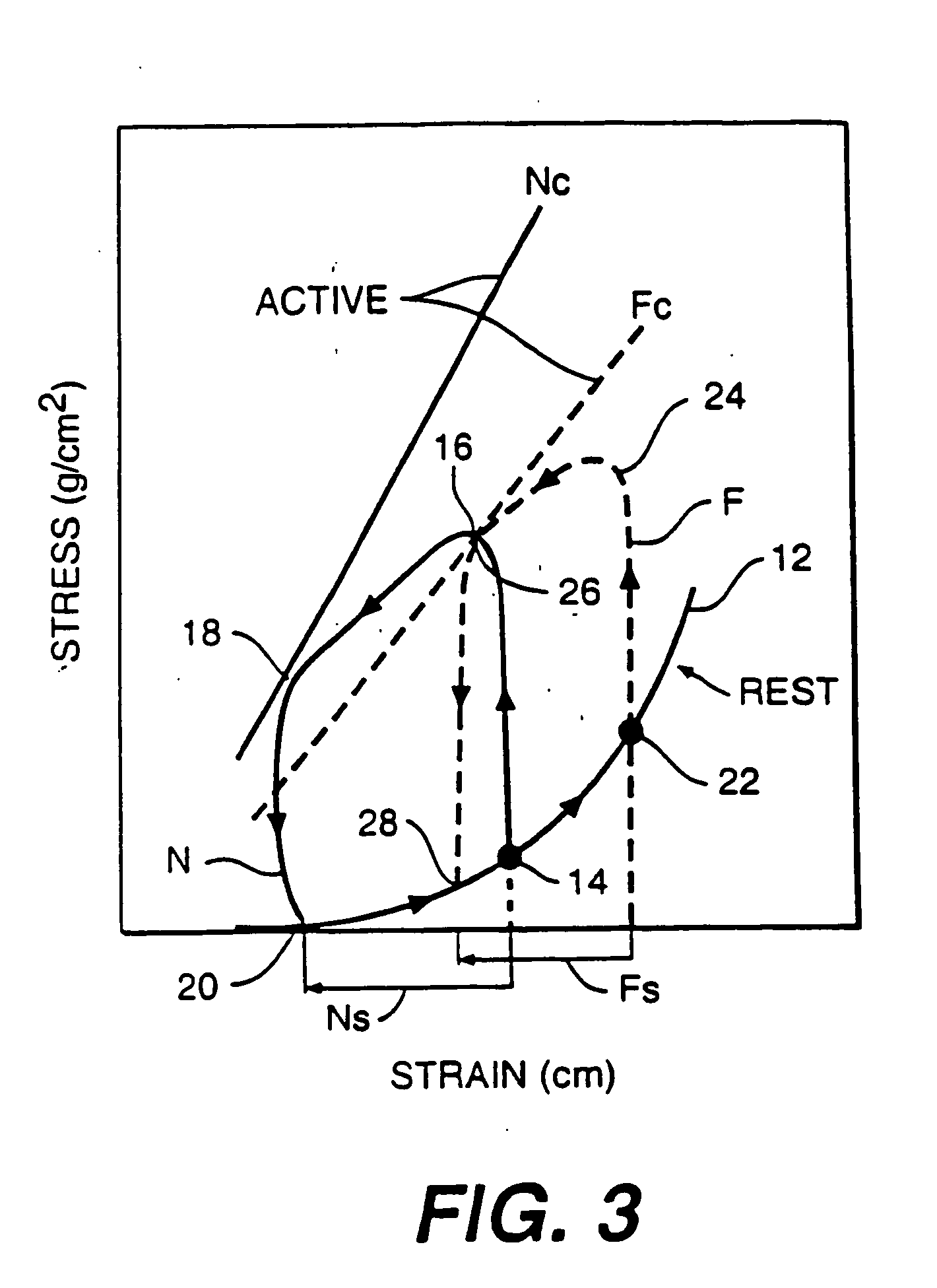 Stress reduction apparatus and method