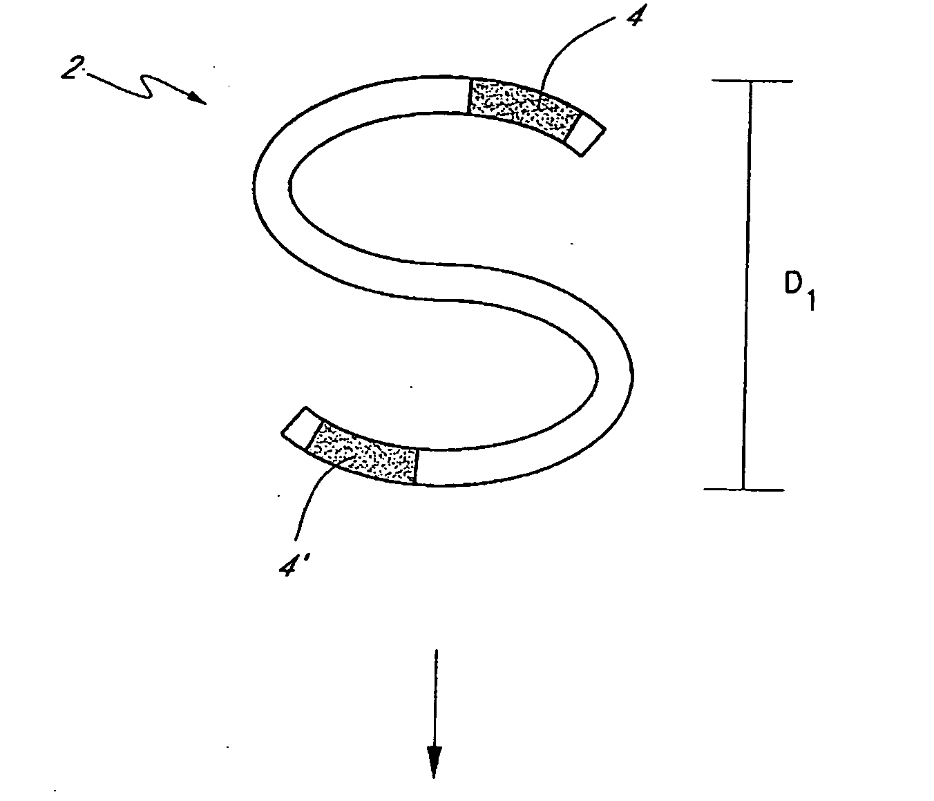 Adjustable embolic aneurysm coil