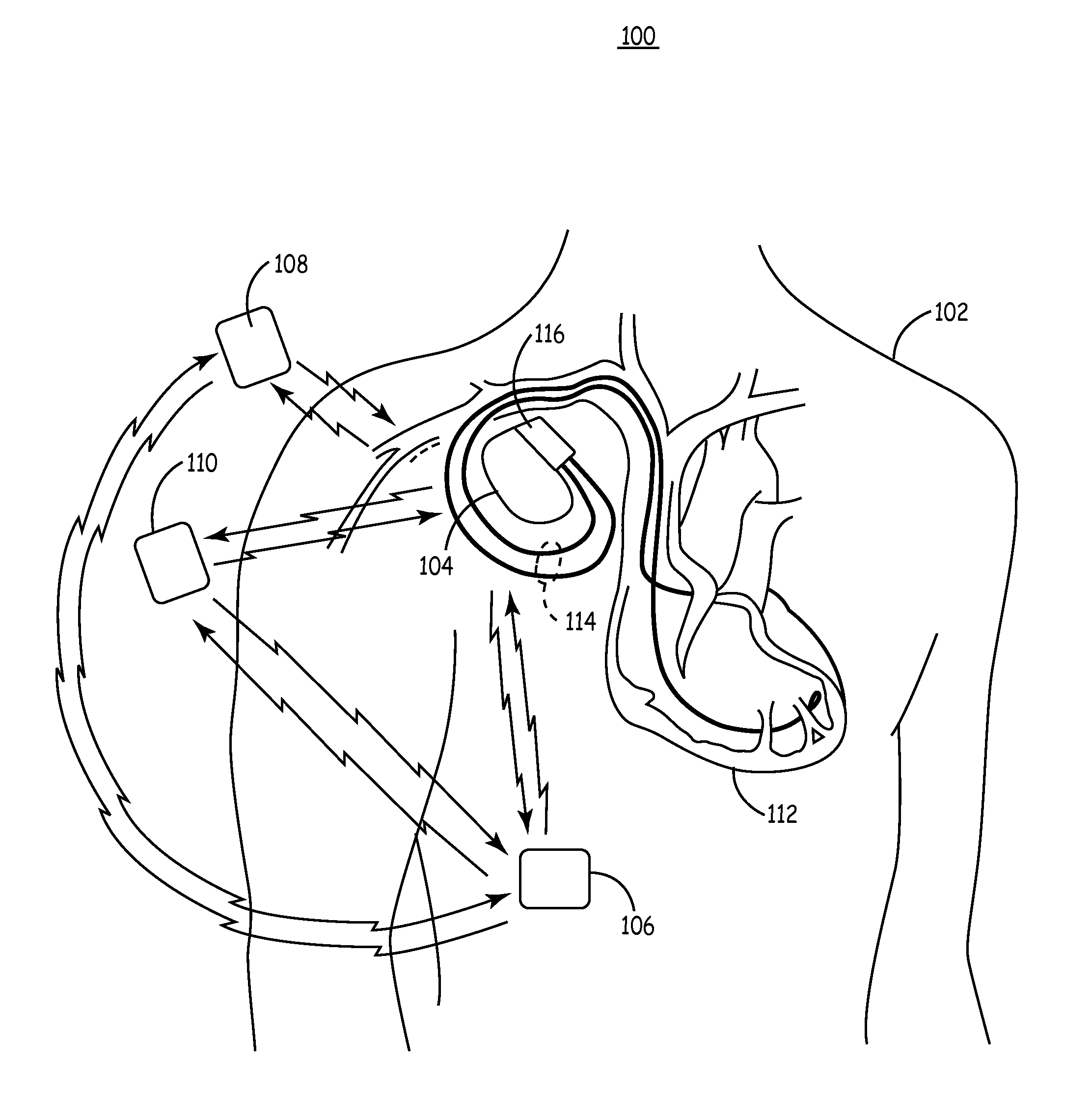 Variable Implantable Medical Device Power Characteristics Based Upon Implant Depth