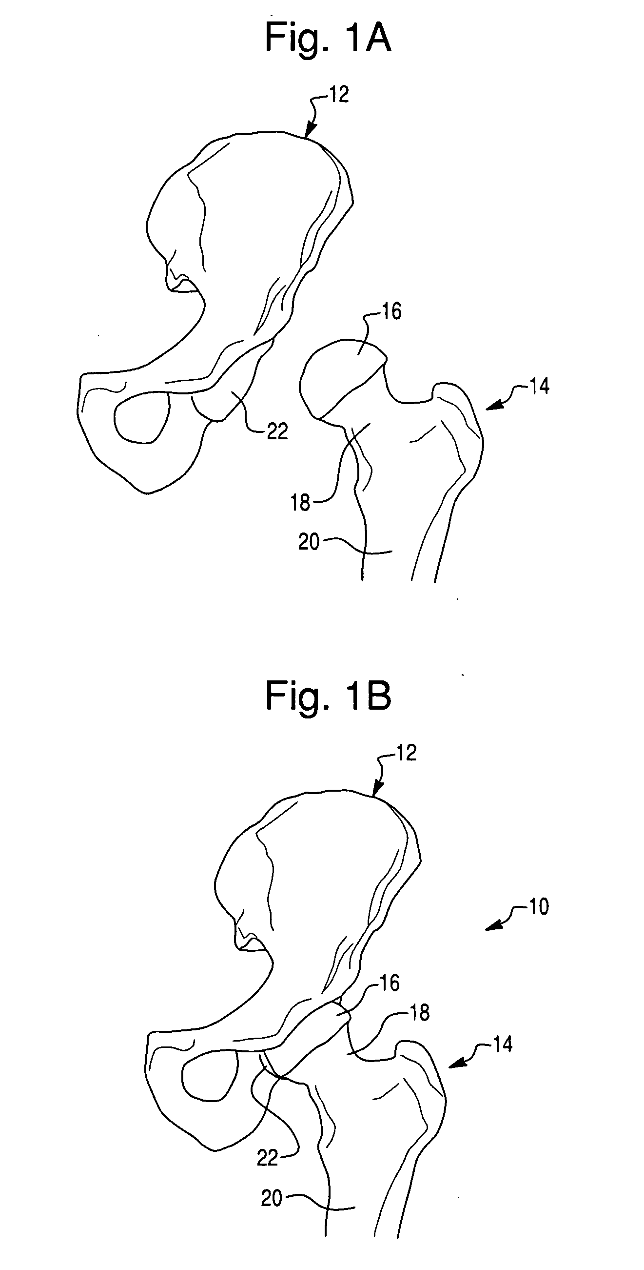 Tool, kit-of-parts for multi-functional tool, and robotic system for same