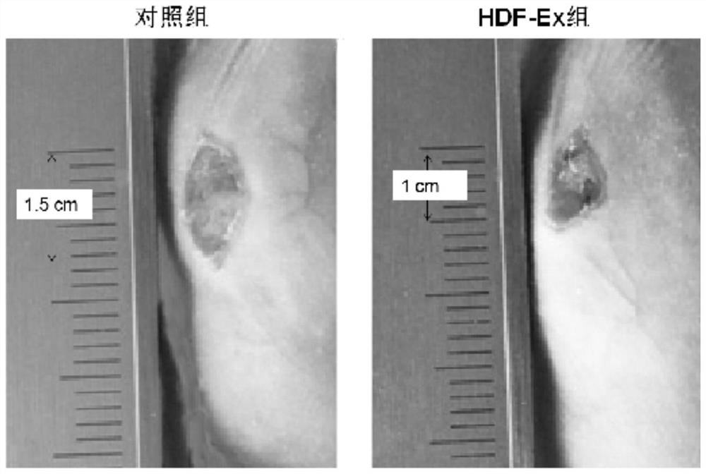 Preparation and separation method of human skin fibroblast exosome