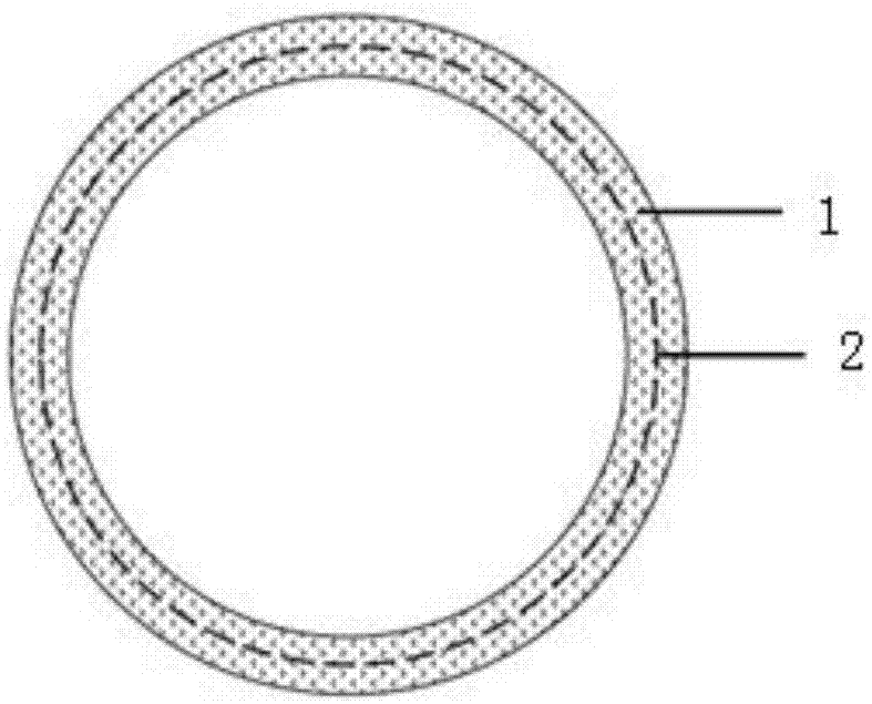 Drug coating stent based on HIV protease inhibitor saquinavir as well as preparation method and application thereof