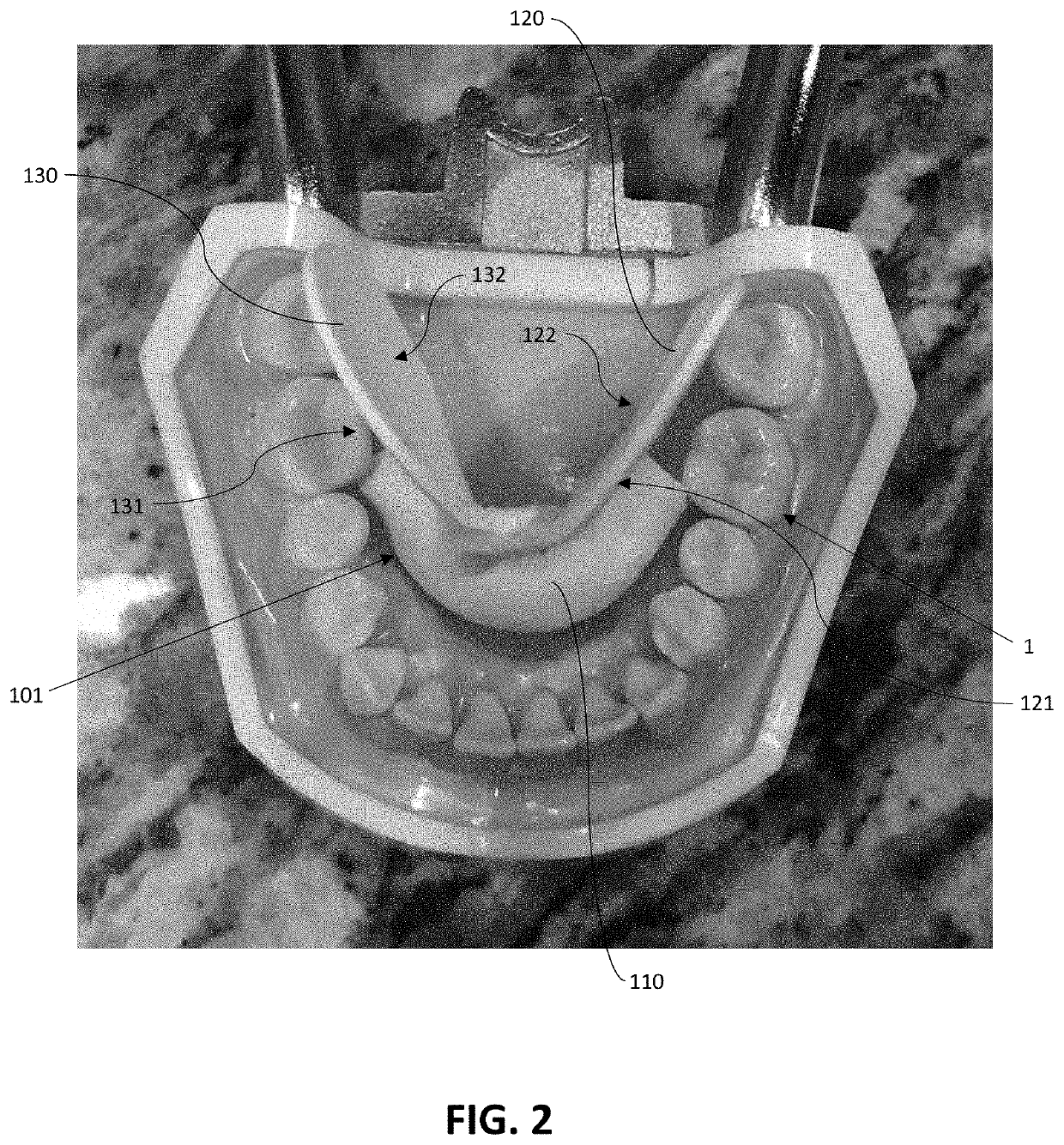 Dental Apparatus For Restricting Tongue Movement During Examinations And Procedures