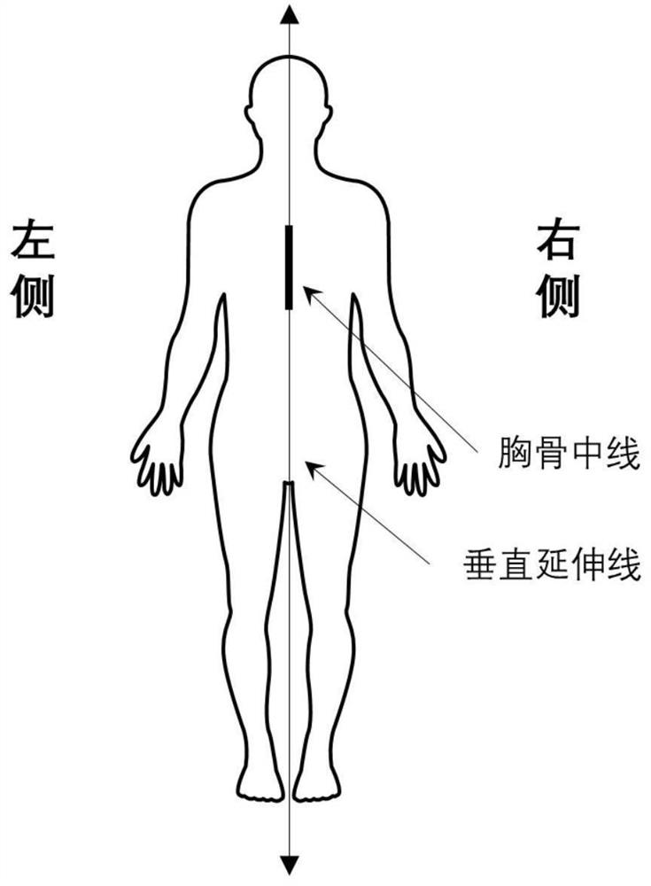 Hidden fatal injury detection method and detection system based on UWB biological radar