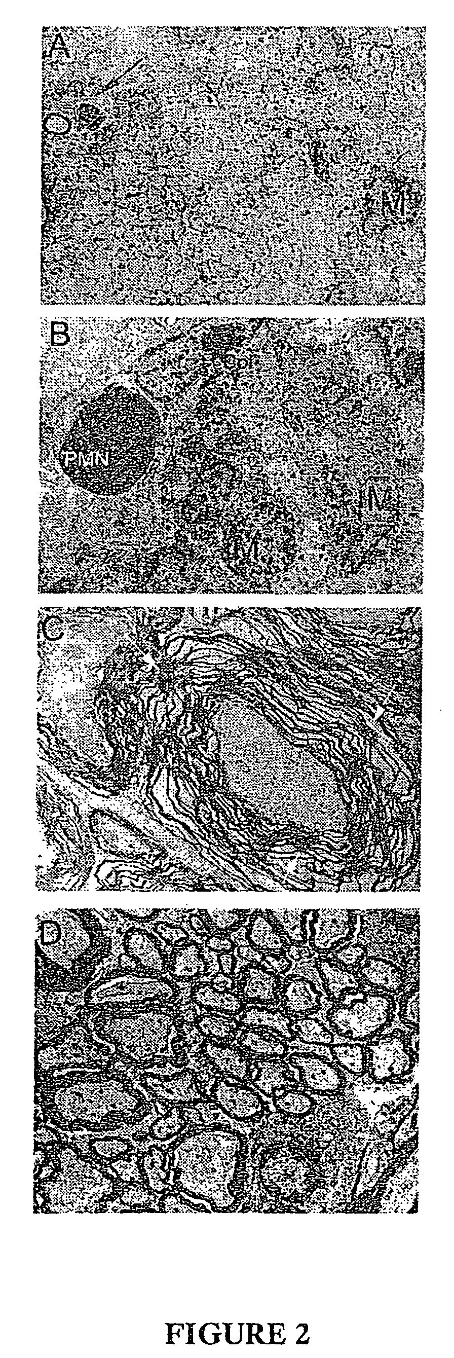 Composition for neuronal regeneration comprising myelin-specific antibodies and complement proteins