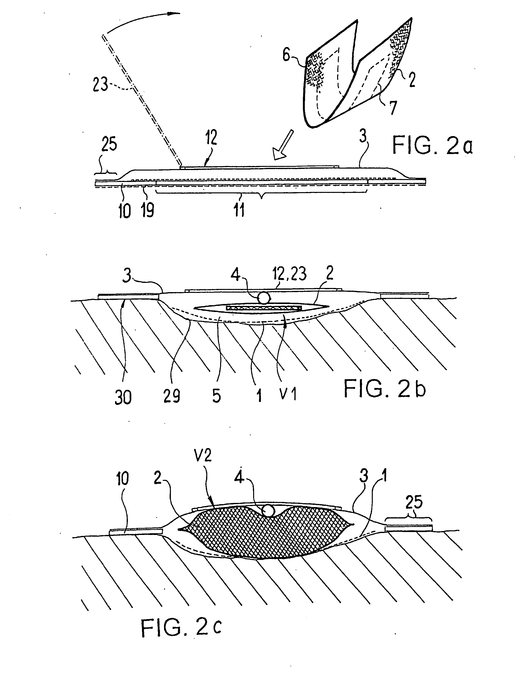 Drainage Device for the Treating Wounds Using a Reduced Pressure