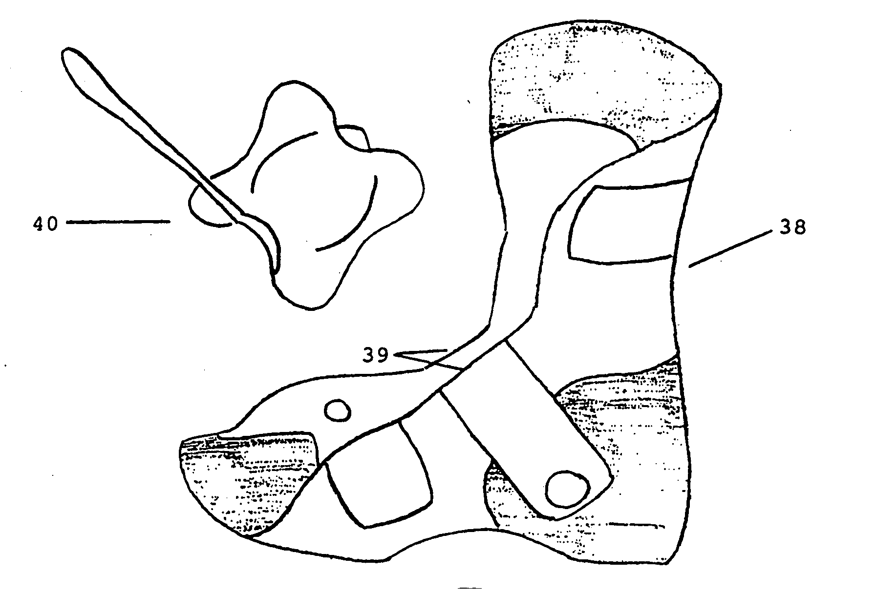 Donning facilitator for dorsal wrap-around ankle-foot orthosis