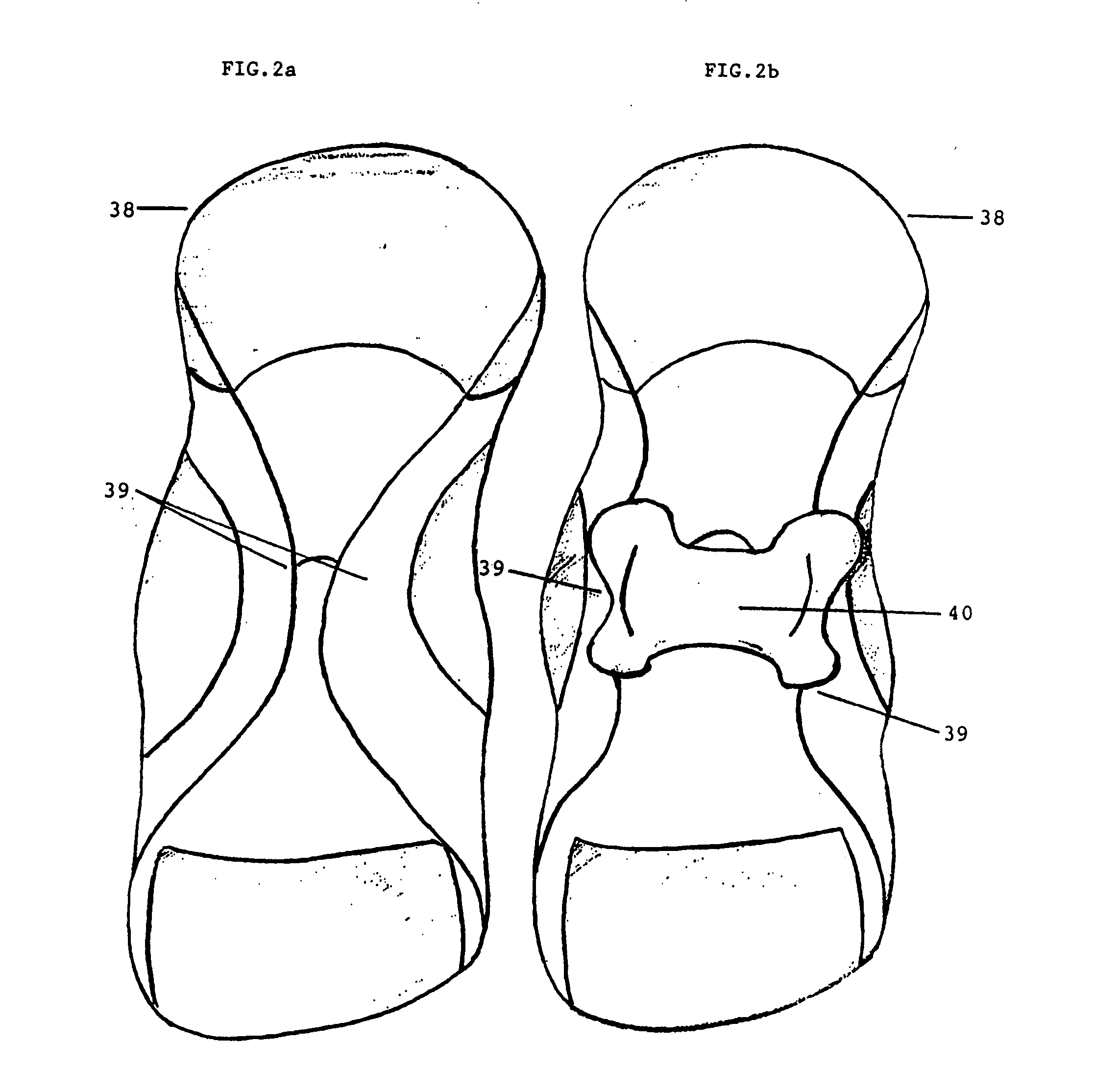 Donning facilitator for dorsal wrap-around ankle-foot orthosis