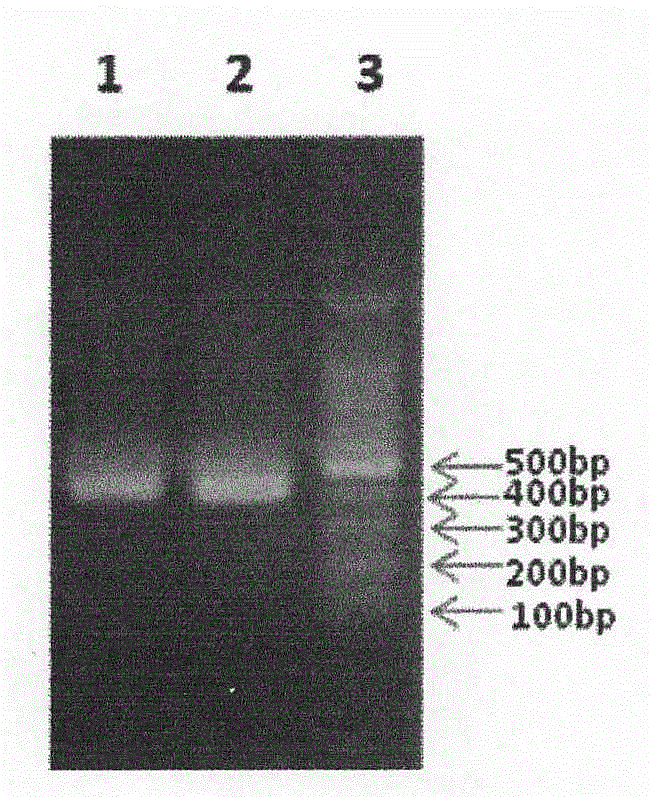 Enzyme-linked immune sorbent assay (ELISA) kit for detecting Shiga toxin II (StxII)