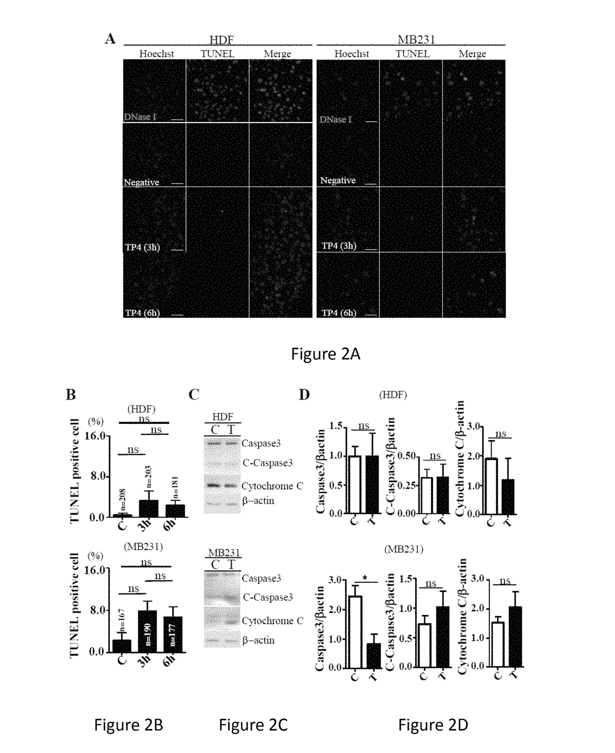 Use of an antimicrobial peptide TP4 in treating a cancer