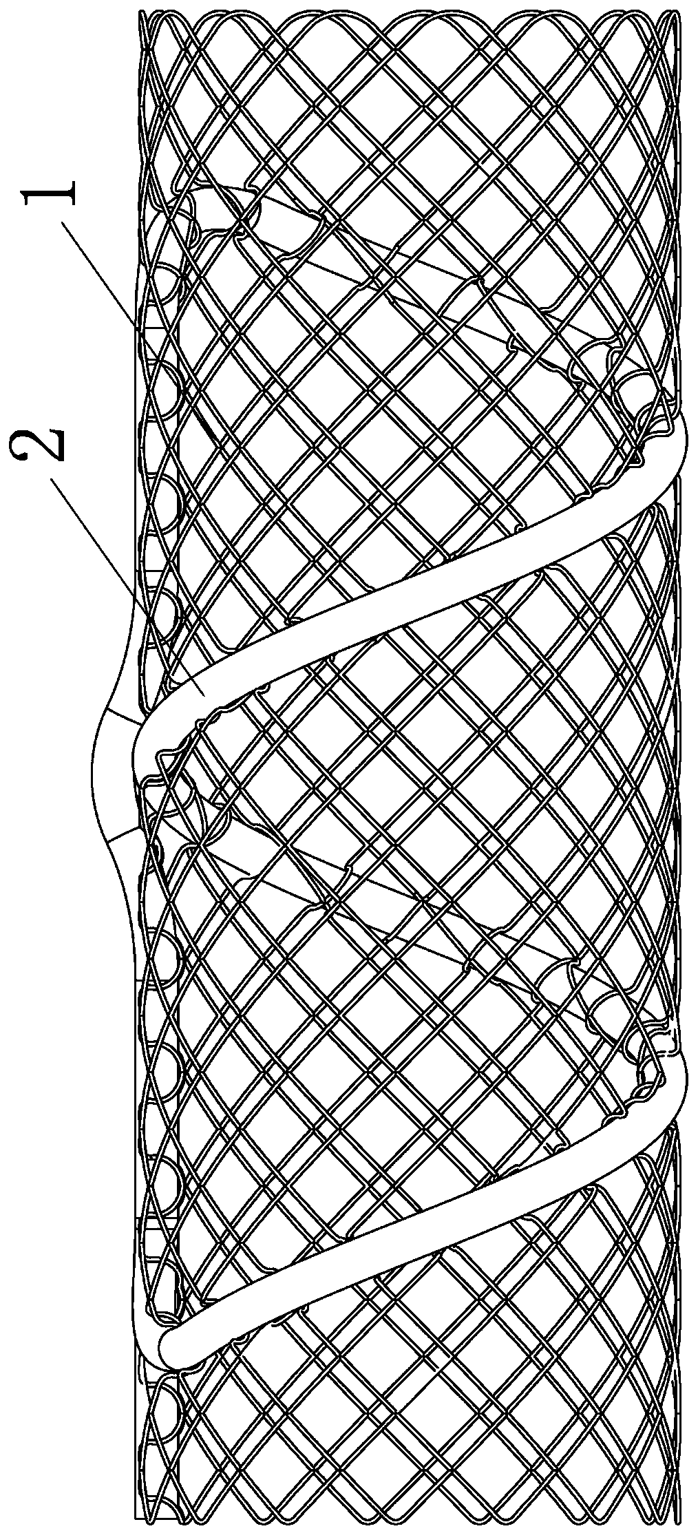 Spiral close-range radionuclide radiotherapy device and particle automatic loading assembly