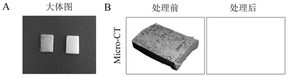 Periosteum-bone complex for reconstruction of soft tissue-bone immune repair environment and preparation method of periosteum-bone complex