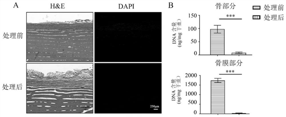 Periosteum-bone complex for reconstruction of soft tissue-bone immune repair environment and preparation method of periosteum-bone complex