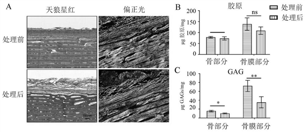 Periosteum-bone complex for reconstruction of soft tissue-bone immune repair environment and preparation method of periosteum-bone complex