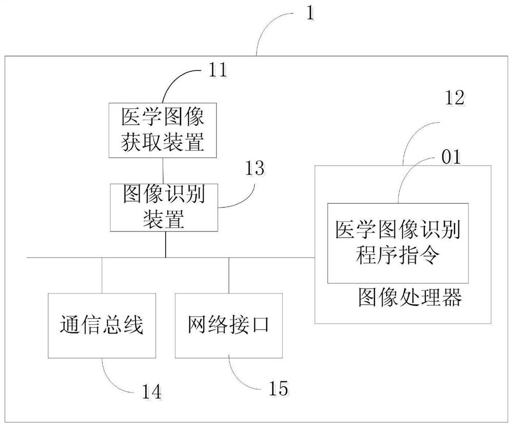 Medical image recognition method and system based on deep learning