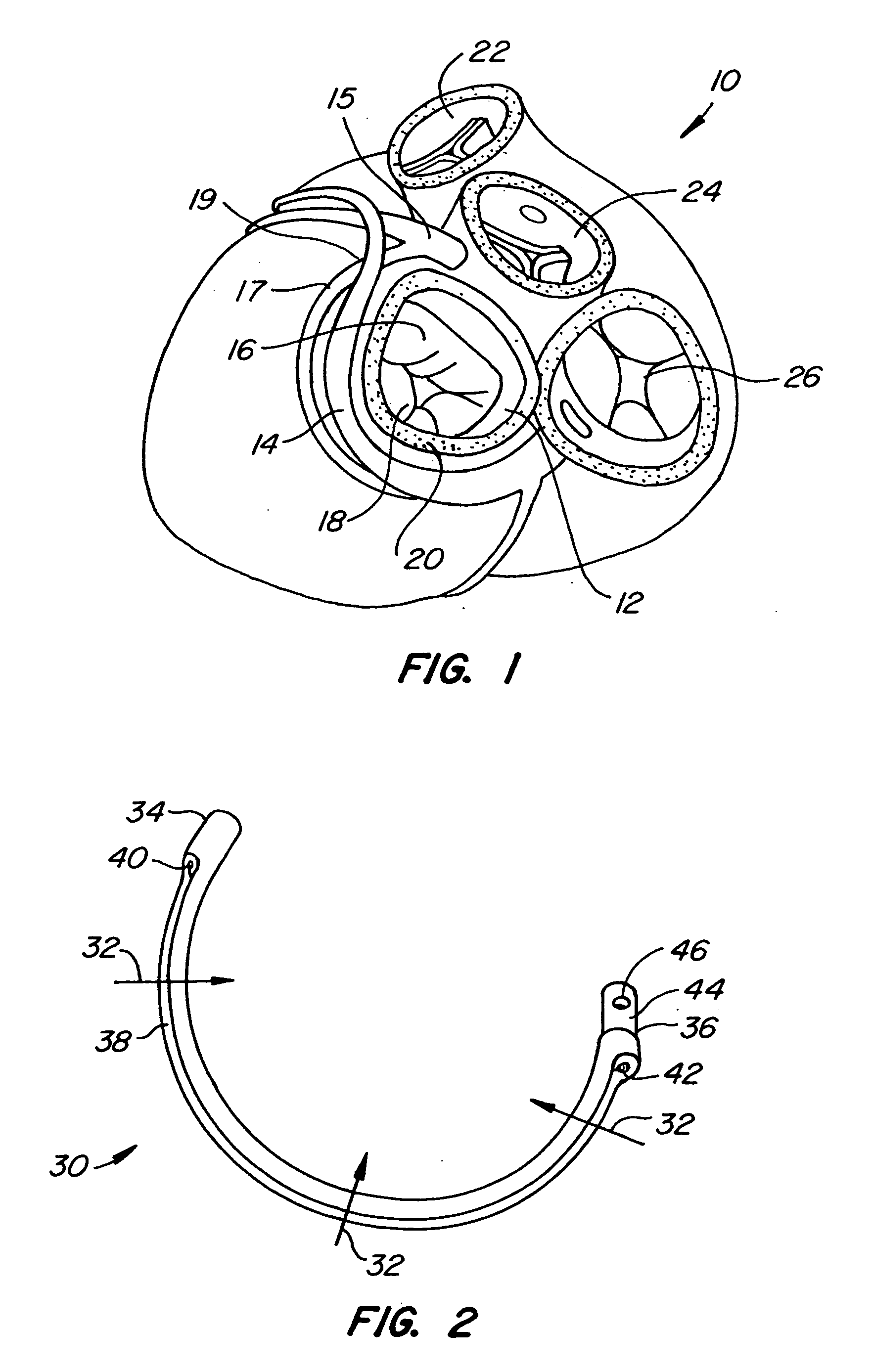 Mitral valve therapy device, system and method