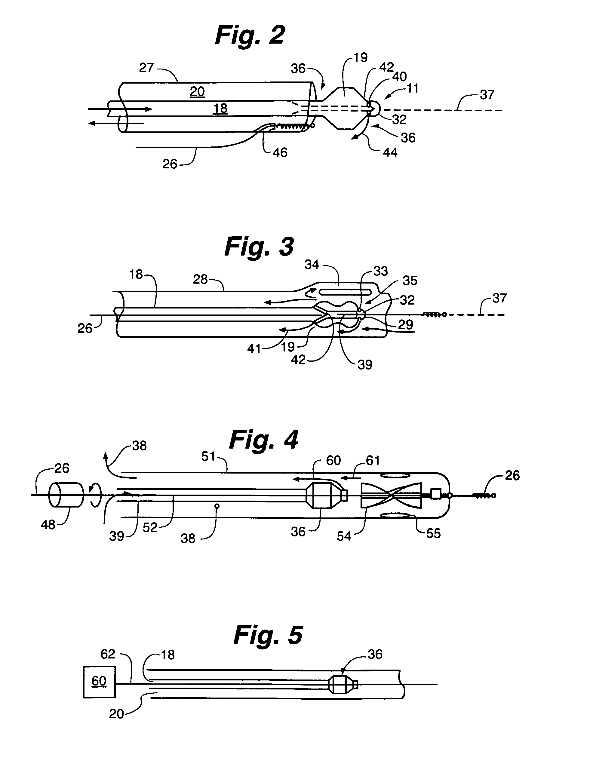 Method of removing particulate debris with an interventional device
