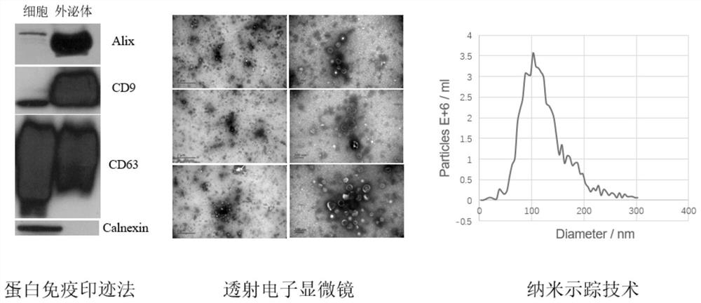 Application of plasma exosome biomarker in screening or curative effect prediction of gastric cancer neoadjuvant chemotherapy sensitive population