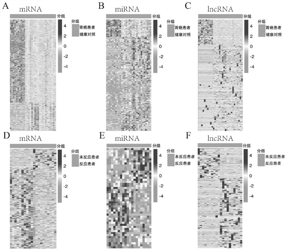 Application of plasma exosome biomarker in screening or curative effect prediction of gastric cancer neoadjuvant chemotherapy sensitive population