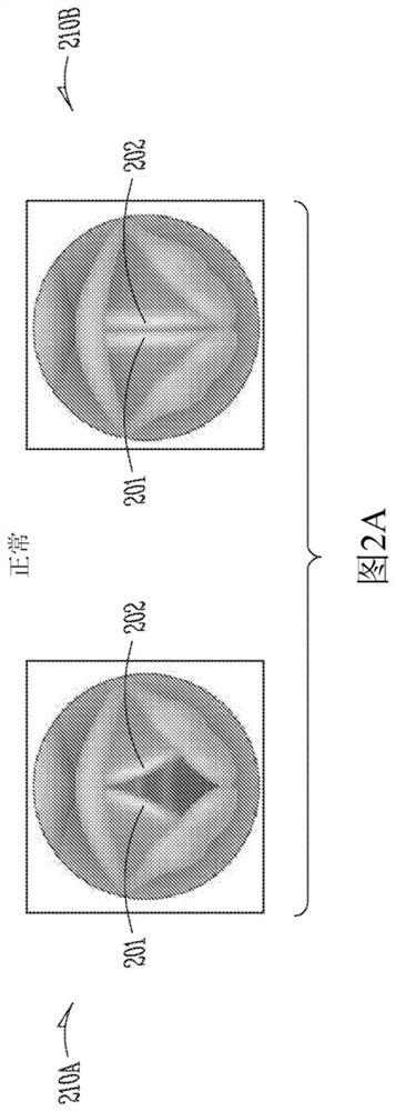 Dynamically controlled soft tissue manipulator