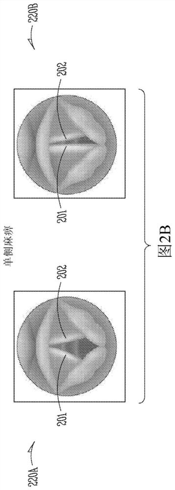 Dynamically controlled soft tissue manipulator