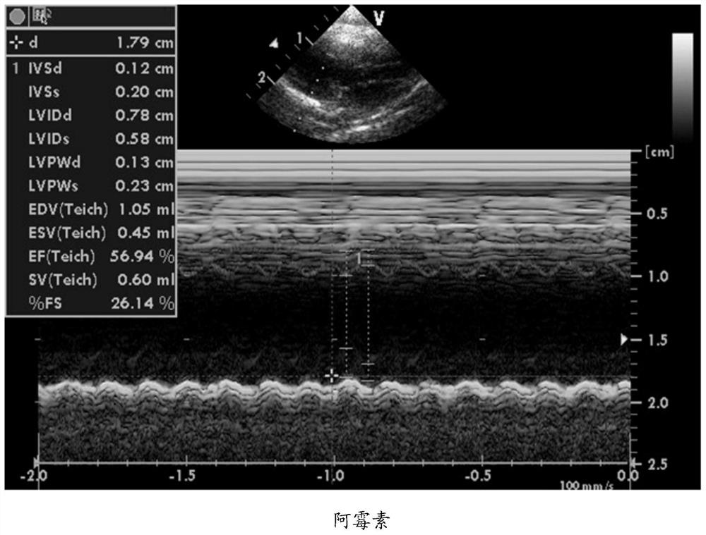 Application of Protohematoxylin a Derivatives in Protecting Heart Injury Caused by Chemotherapy Drugs