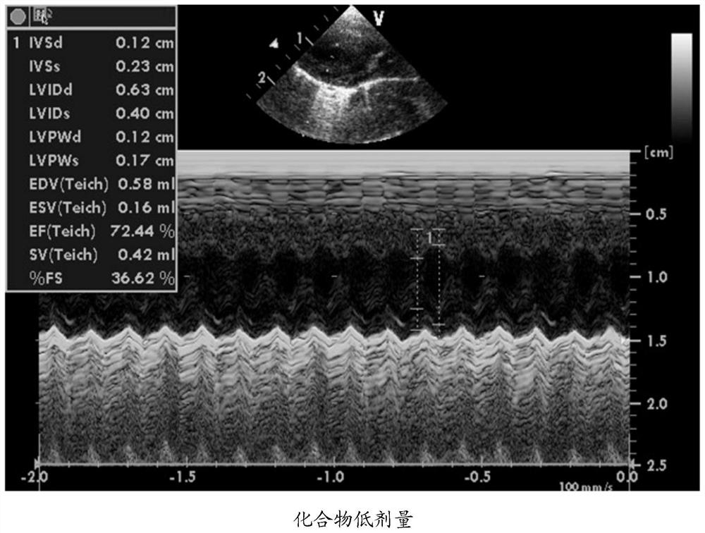 Application of Protohematoxylin a Derivatives in Protecting Heart Injury Caused by Chemotherapy Drugs