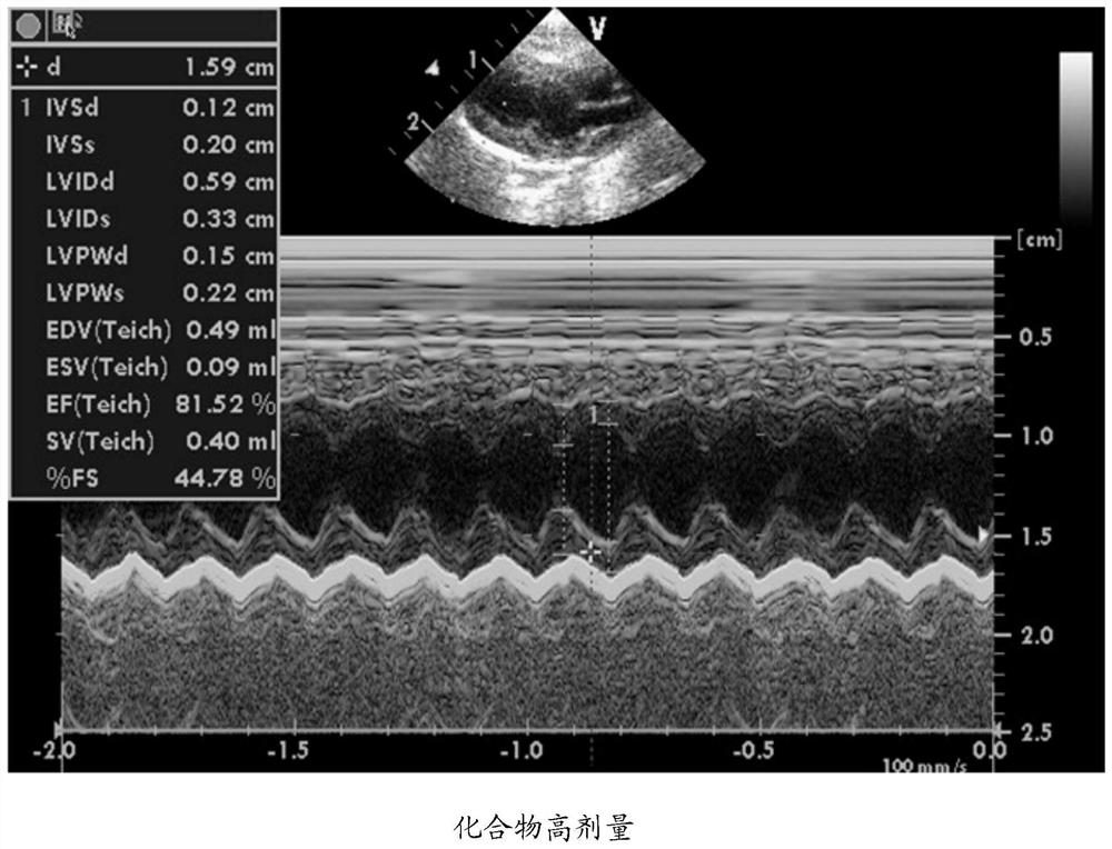 Application of Protohematoxylin a Derivatives in Protecting Heart Injury Caused by Chemotherapy Drugs