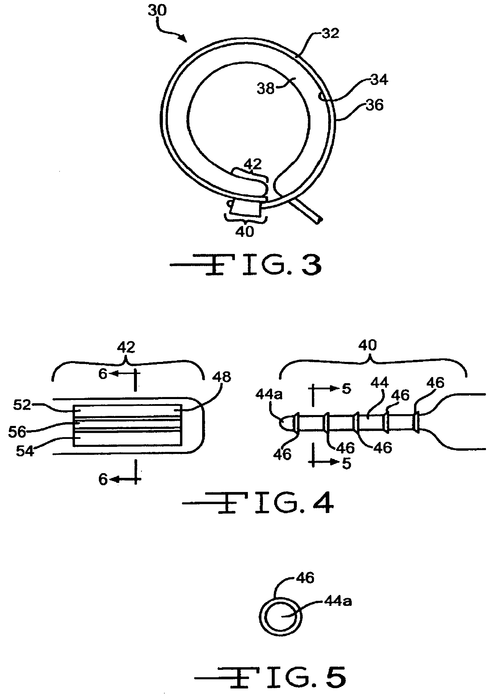 Implantable band with attachment mechanism having dissimilar material properties