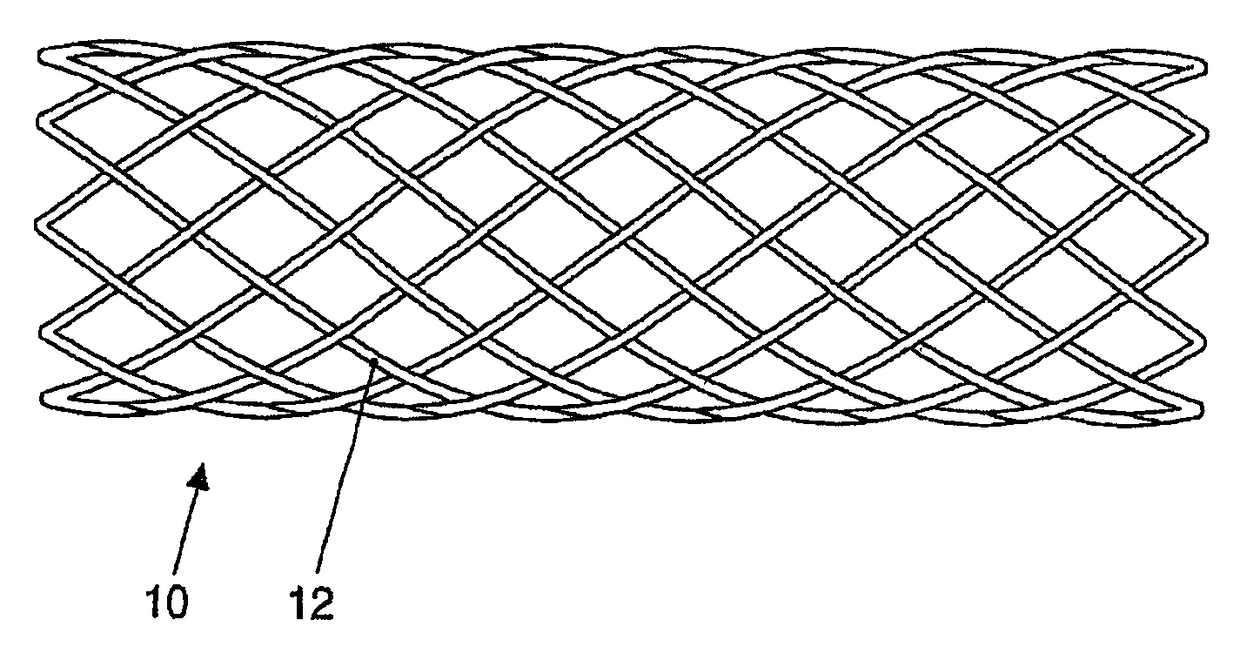 Absorbable medical implant made of fiber-reinforced magnesium or fiber-reinforced magnesium alloys