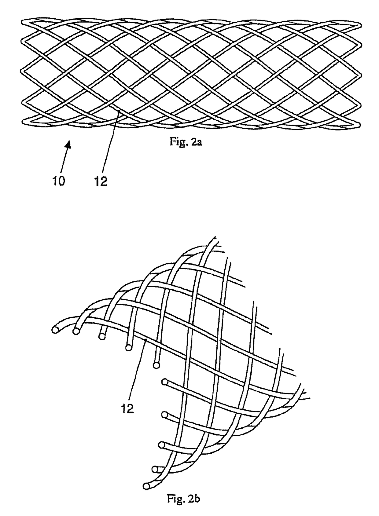 Absorbable medical implant made of fiber-reinforced magnesium or fiber-reinforced magnesium alloys