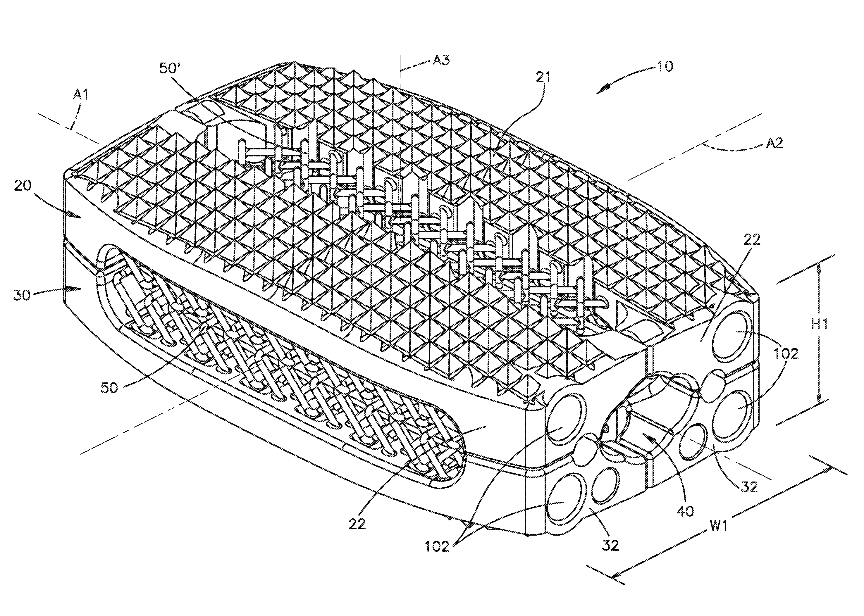 Expandable intervertebral implant and associated method of manufacturing the same
