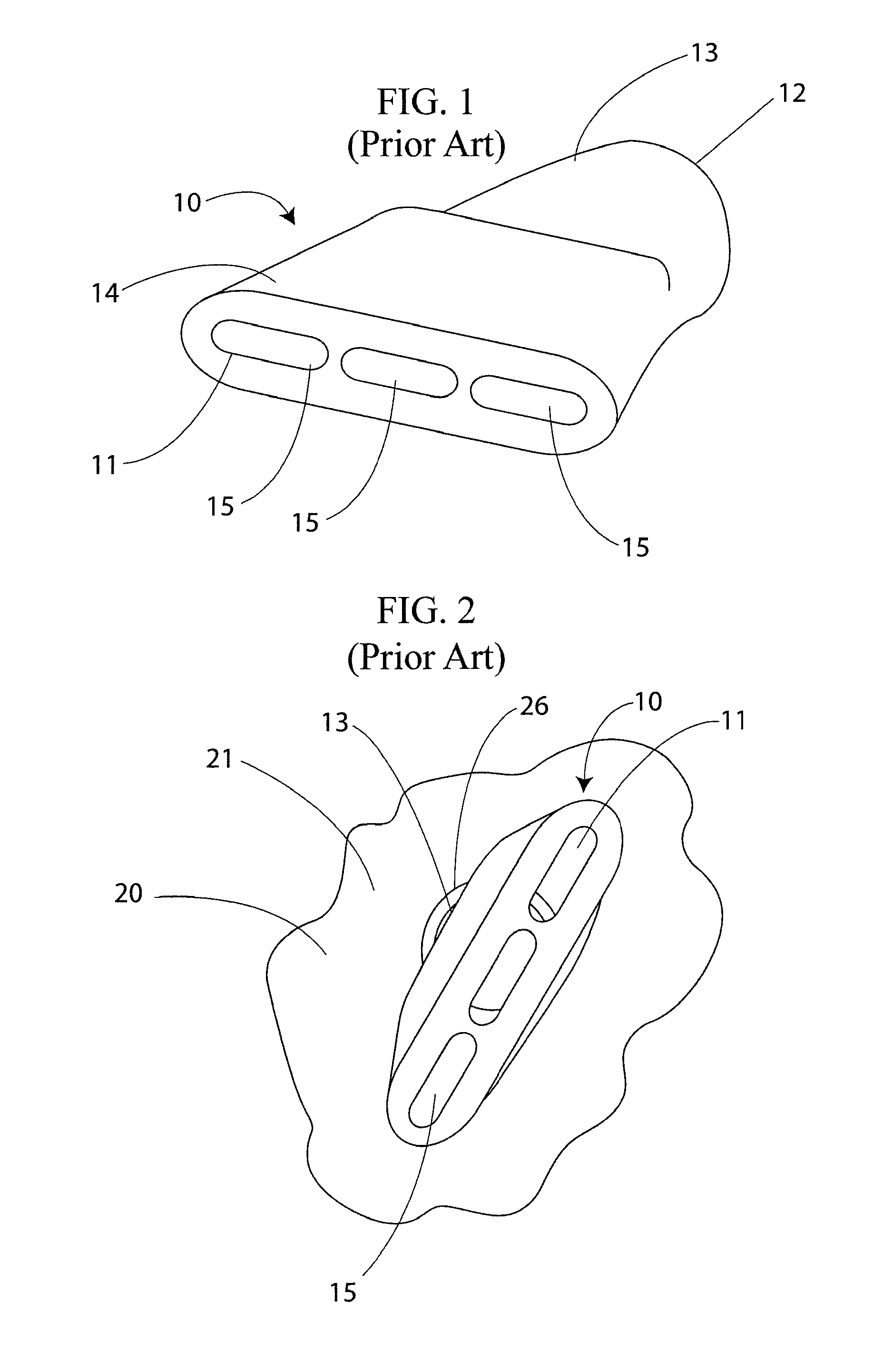 Removable nozzle for use with air cannons and aerators and method for replacing same