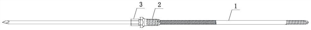 Self-locking elastic pressurizing intramedullary needle