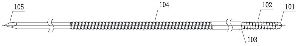 Self-locking elastic pressurizing intramedullary needle