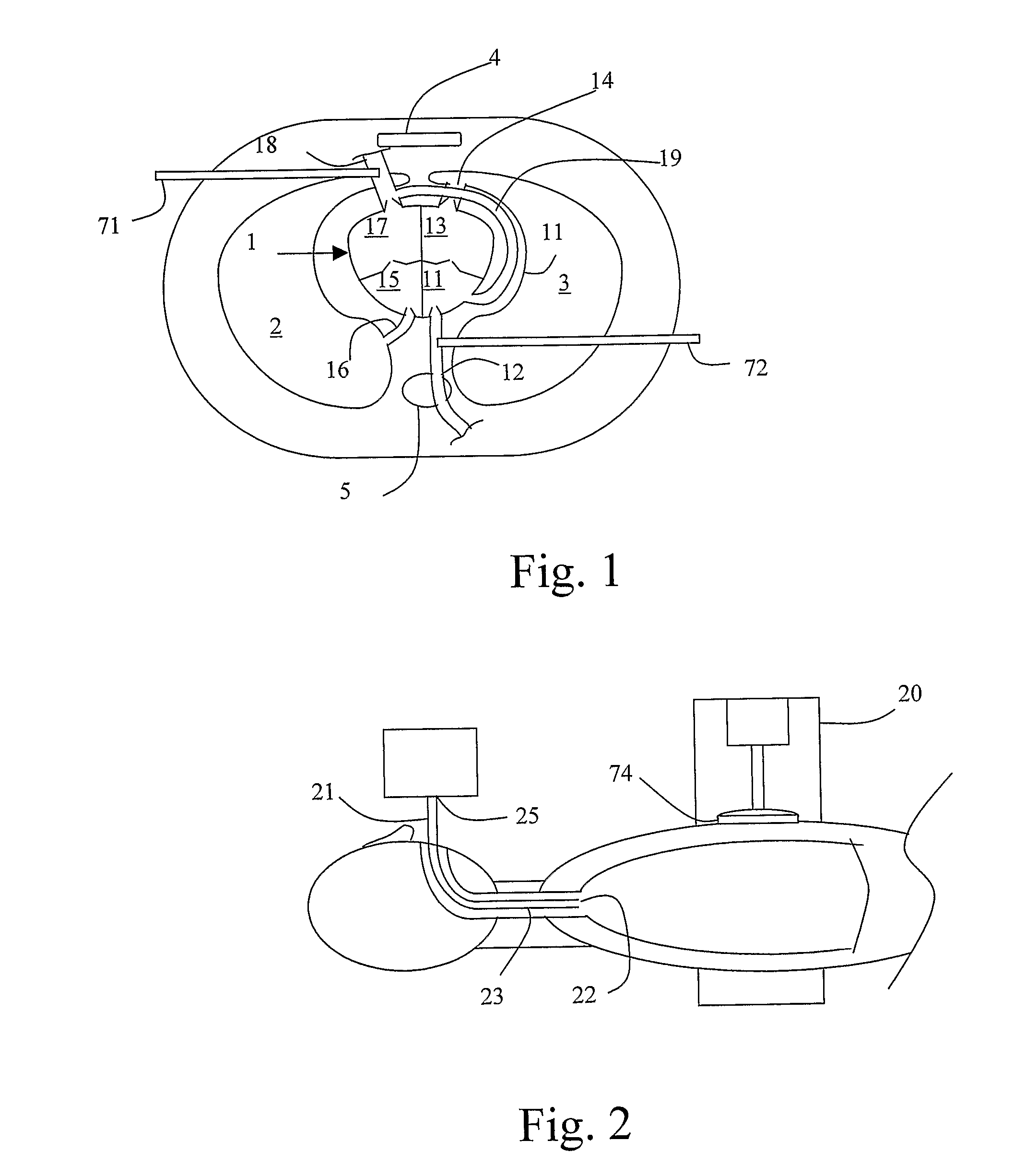 Method and device for gas supply during cardiopulmonary resuscitation