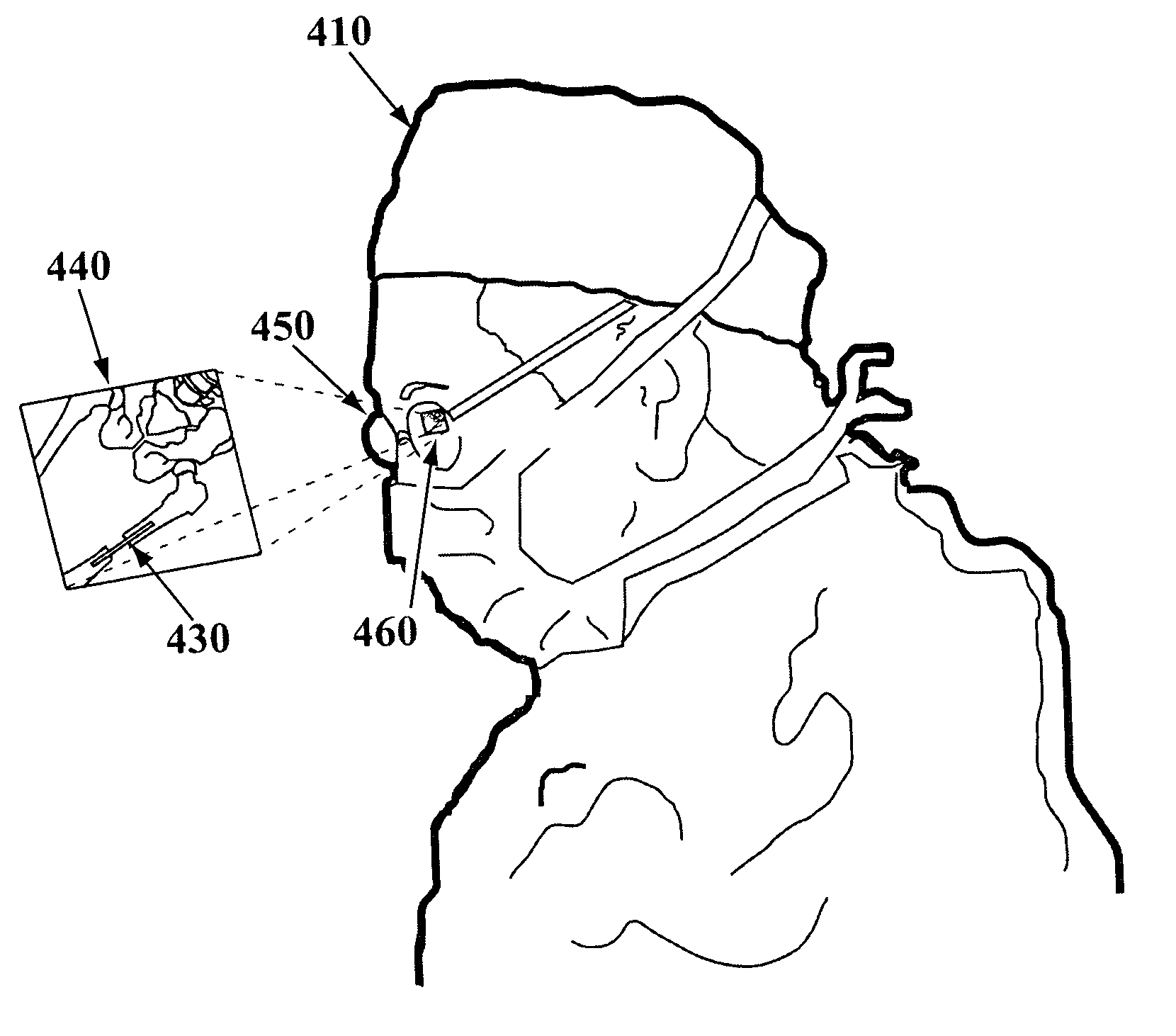 Apparatus for providing visual data during an operation