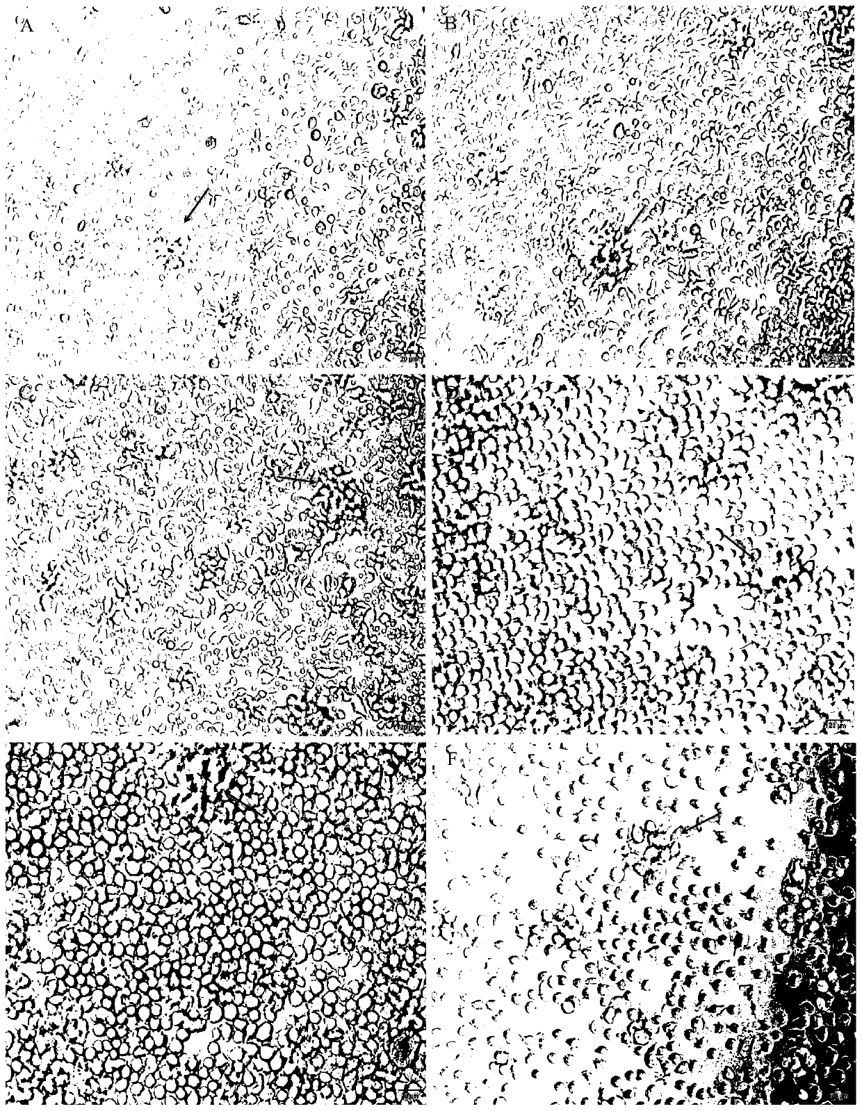 A method for isolation, purification and primary culture of grass carp intestinal macrophages