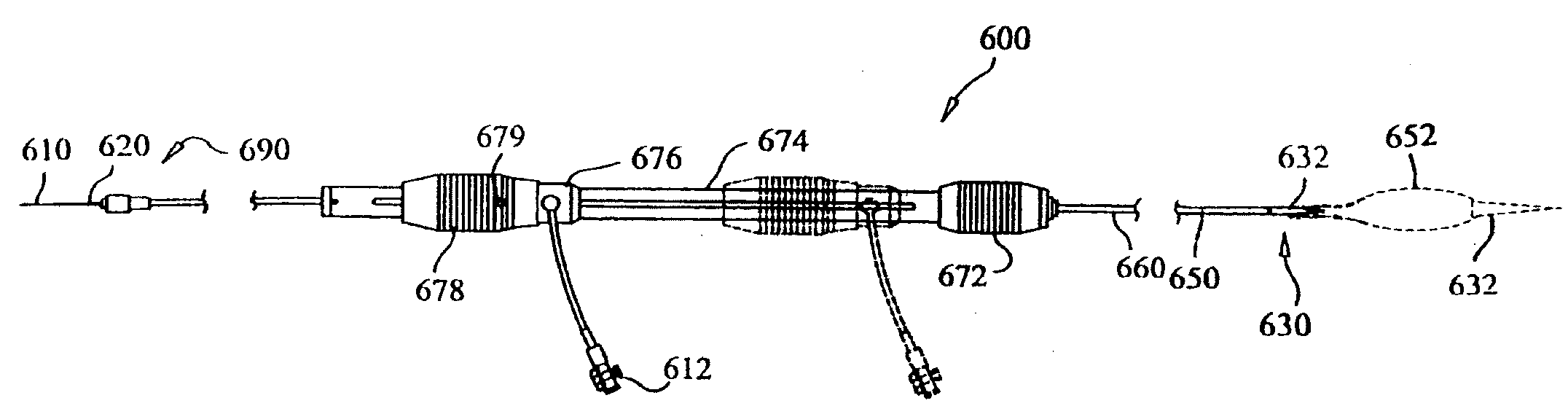 Delivery System and Method for Self-Centering a Proximal End of a Stent Graft