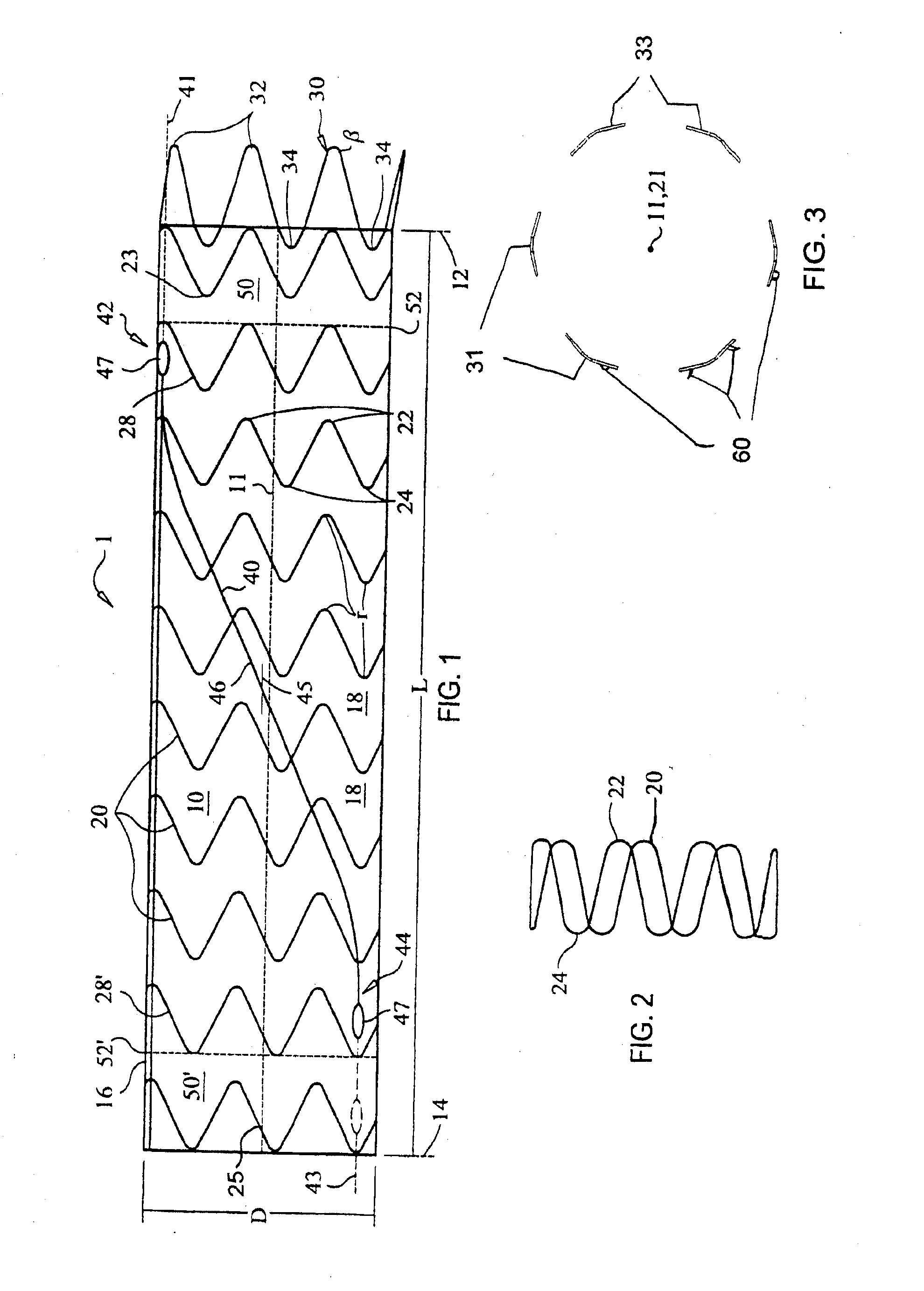 Delivery System and Method for Self-Centering a Proximal End of a Stent Graft