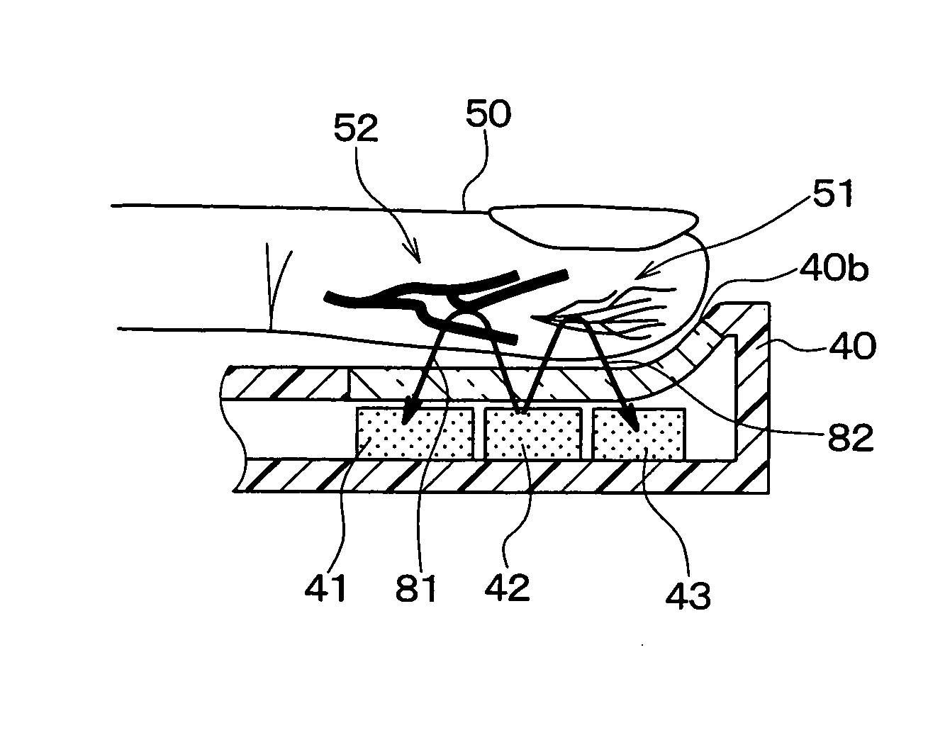 Engine starting controller