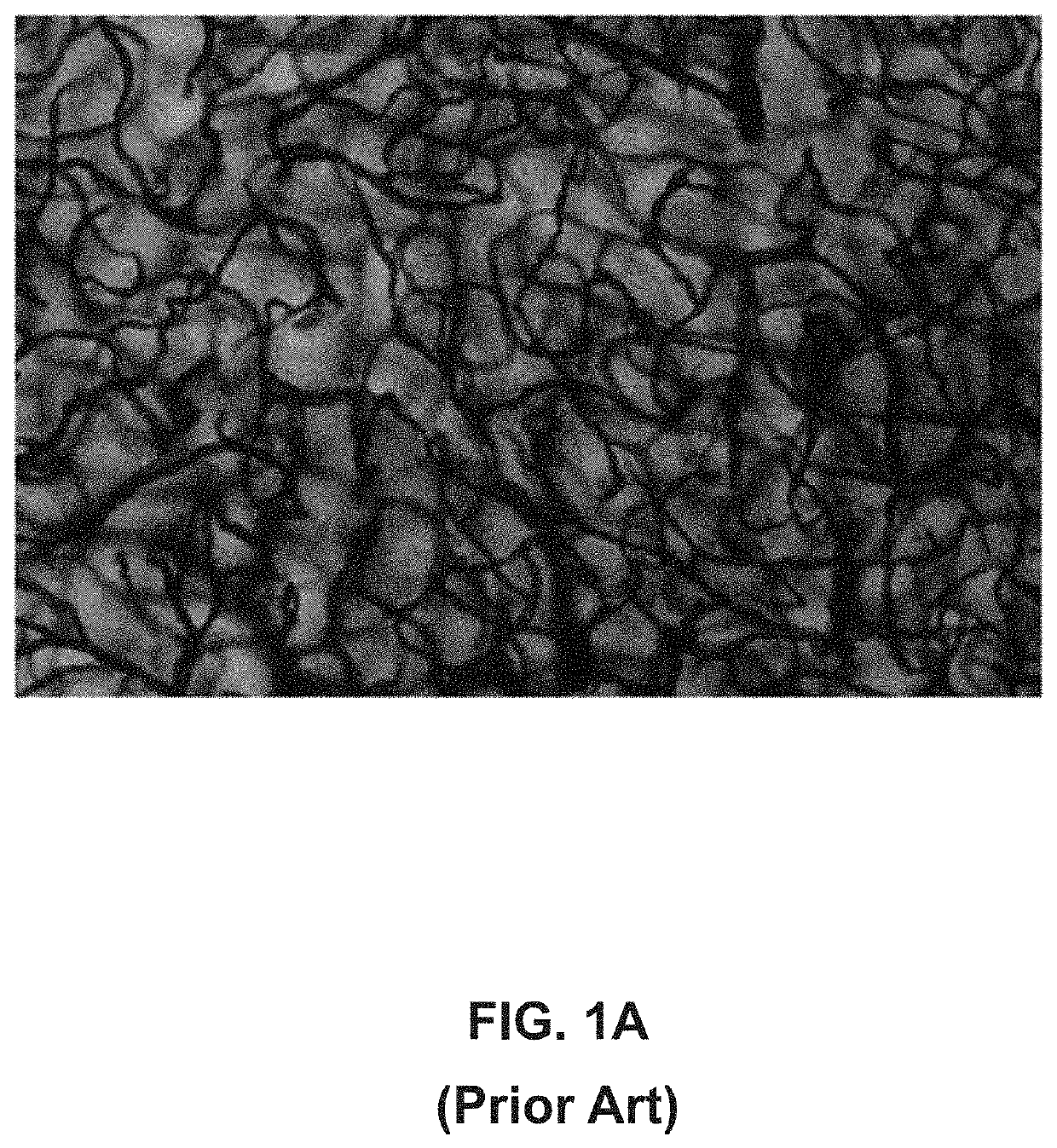 Measuring blood vessel characteristics with MRI