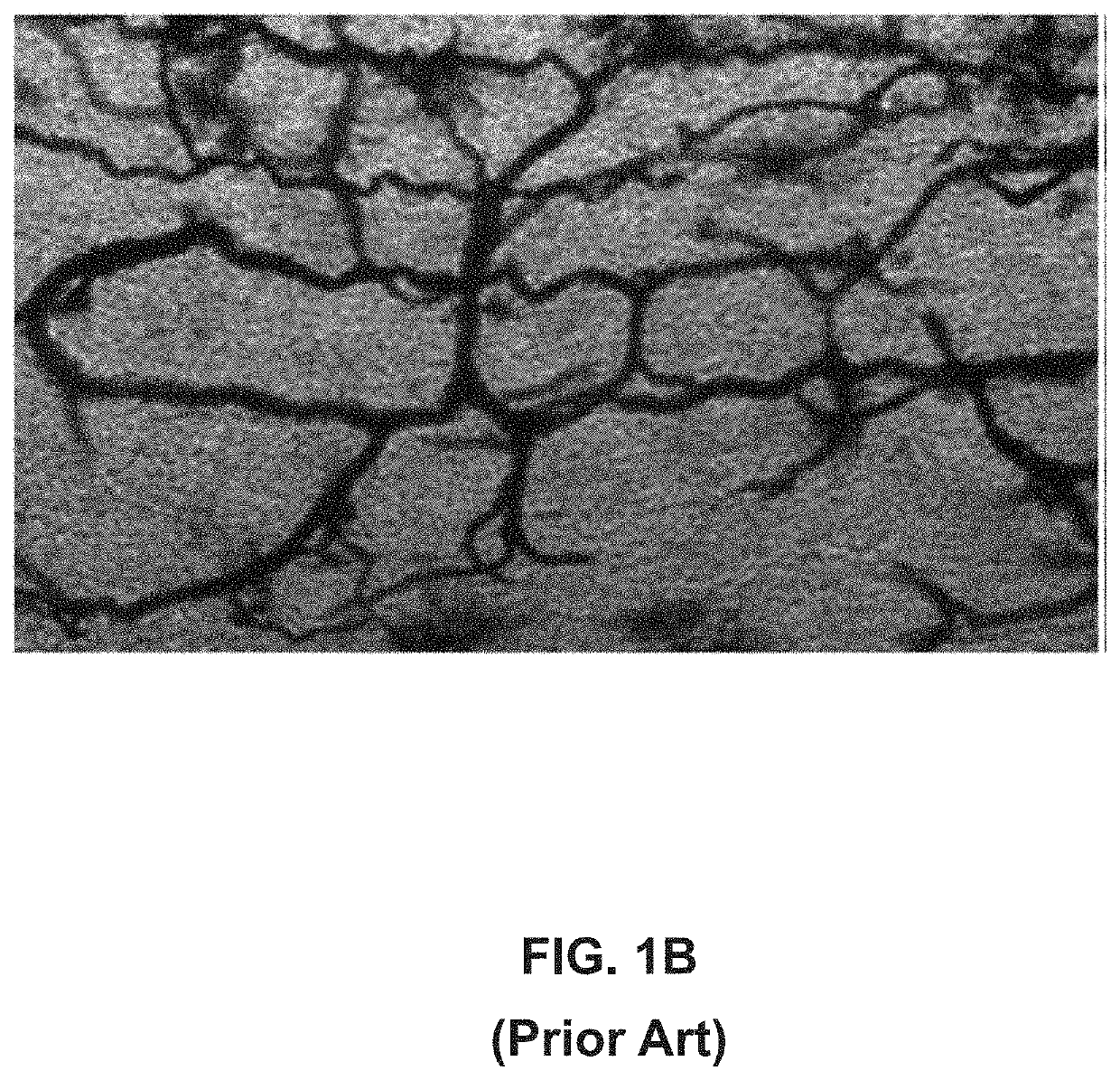 Measuring blood vessel characteristics with MRI