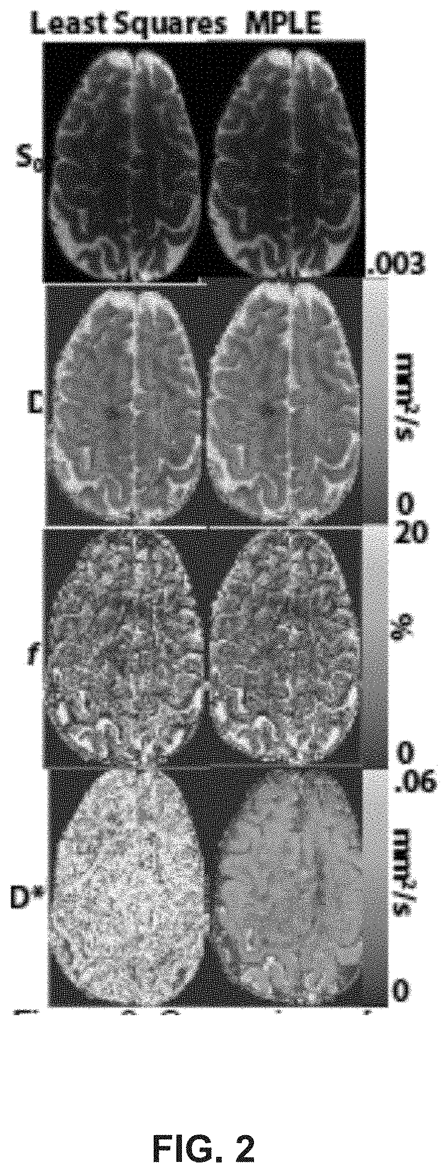 Measuring blood vessel characteristics with MRI