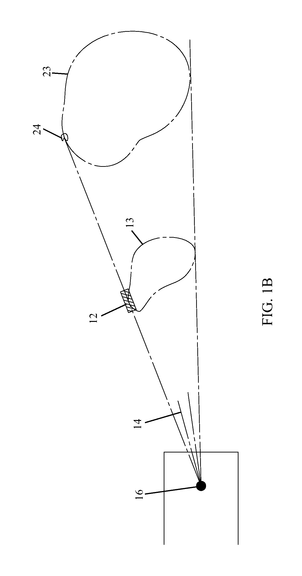 Stereotactic radiotherapy with rotating attenuator